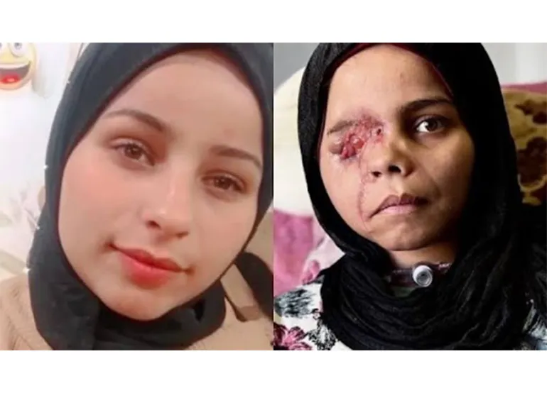 Image showing Nada’s condition before and after the injur