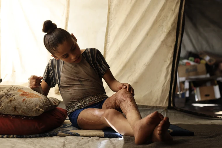 Palestinian child seriously injured in Israeli attacks struggles to walk