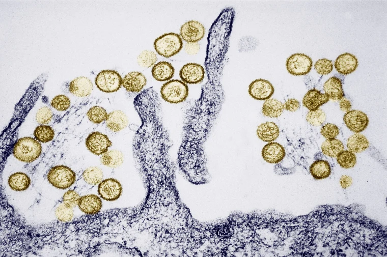 Sin Nombre Virus