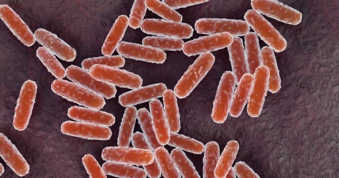 What is pneumonic plague? What to know after woman in Russia diesmysteriously